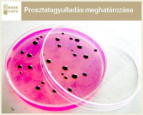prosztatagyulladás megállapítása tenyésztés útján prosztatagyulladás megállapítása tenyésztés útján
